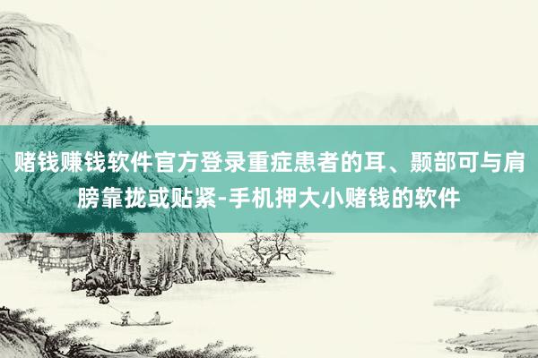 赌钱赚钱软件官方登录重症患者的耳、颞部可与肩膀靠拢或贴紧-手机押大小赌钱的软件